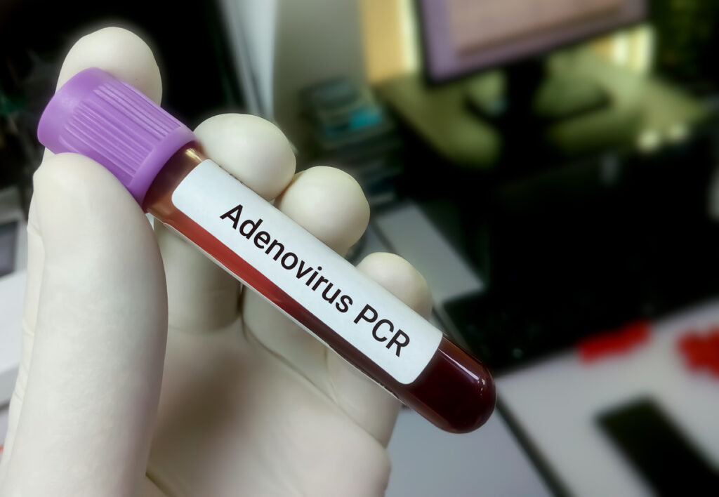 adenovirusul