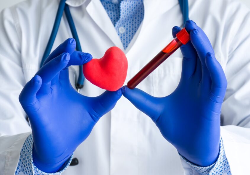 analize pentru inimă