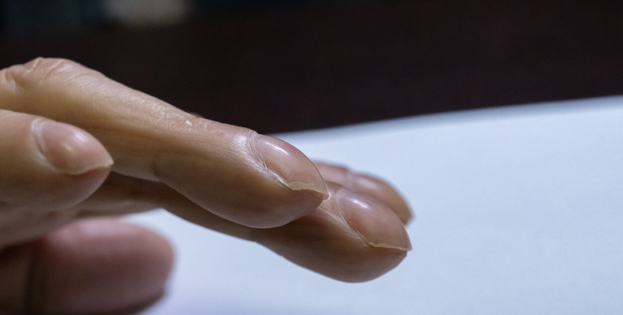 semn de cancer de plămâni