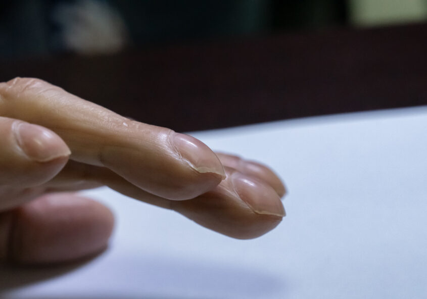 semn de cancer de plămâni