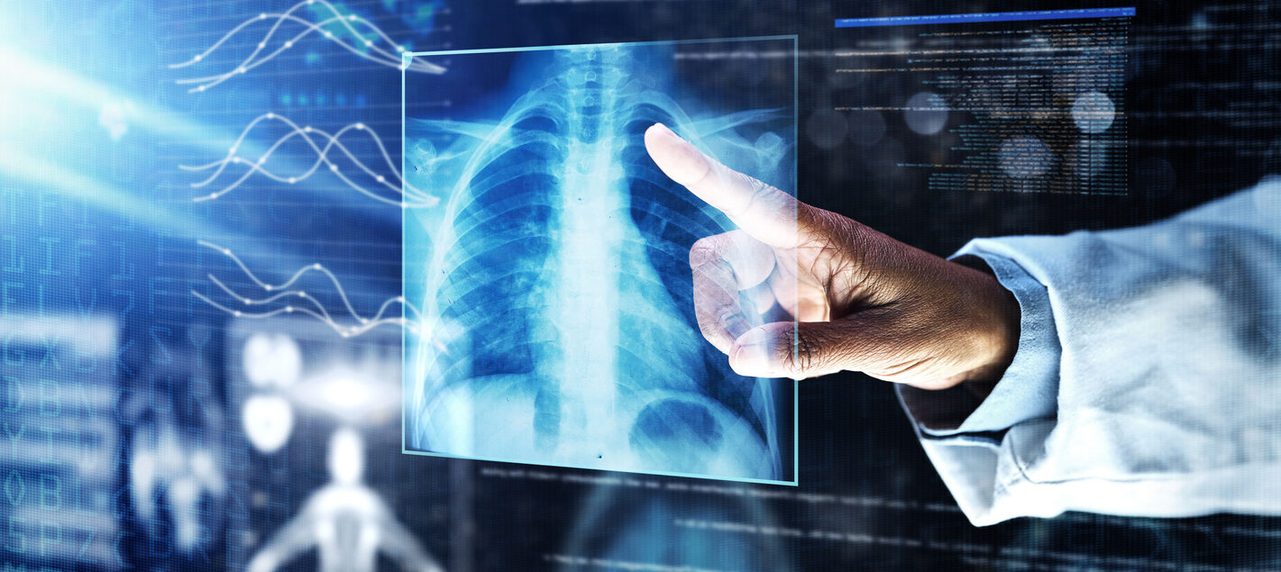 tratamentul cancerului pulmonar