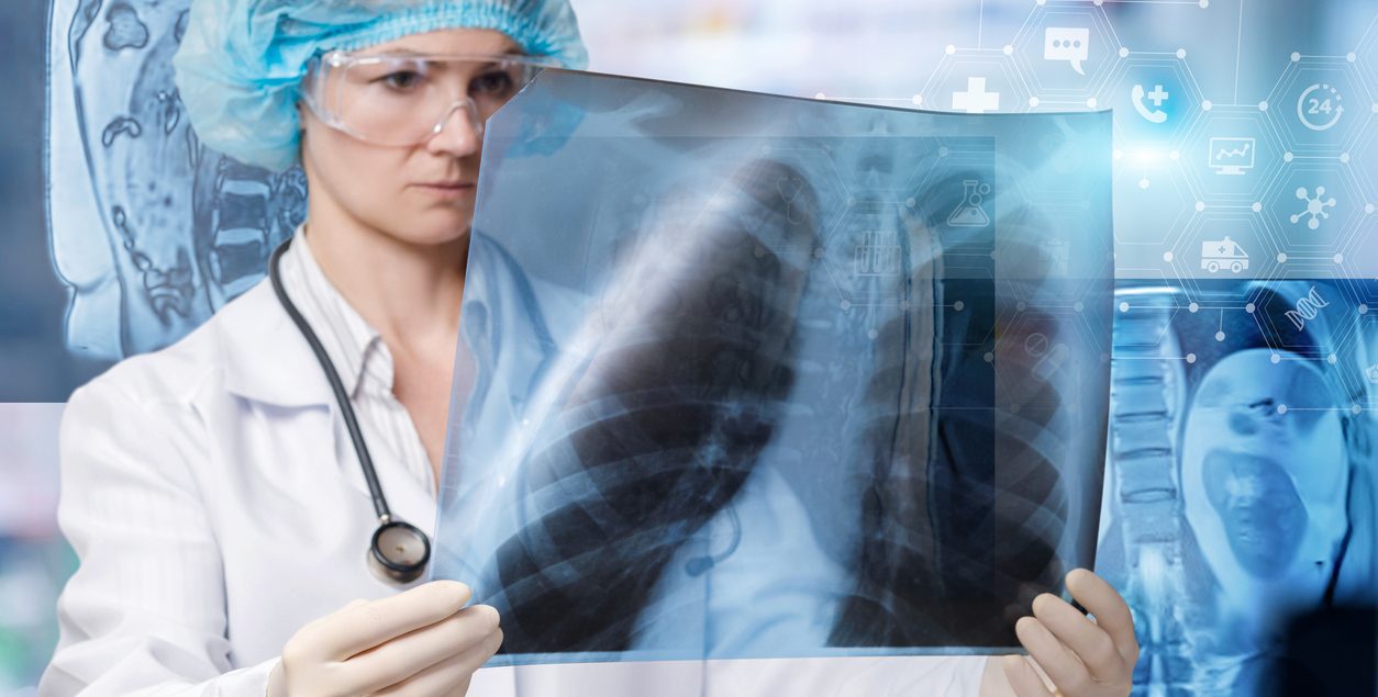 detectarea fibrozei pulmonare