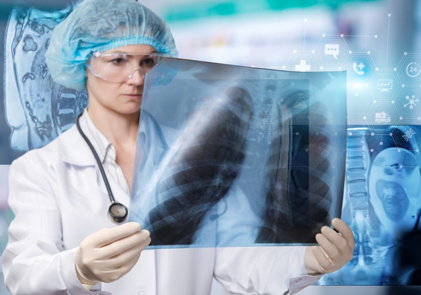 detectarea fibrozei pulmonare