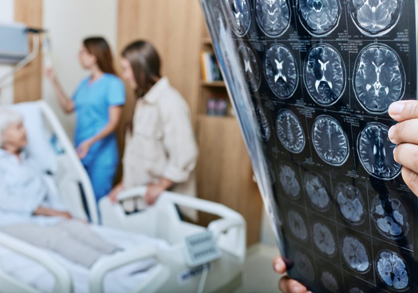 apneea în somn crește riscul de parkinson