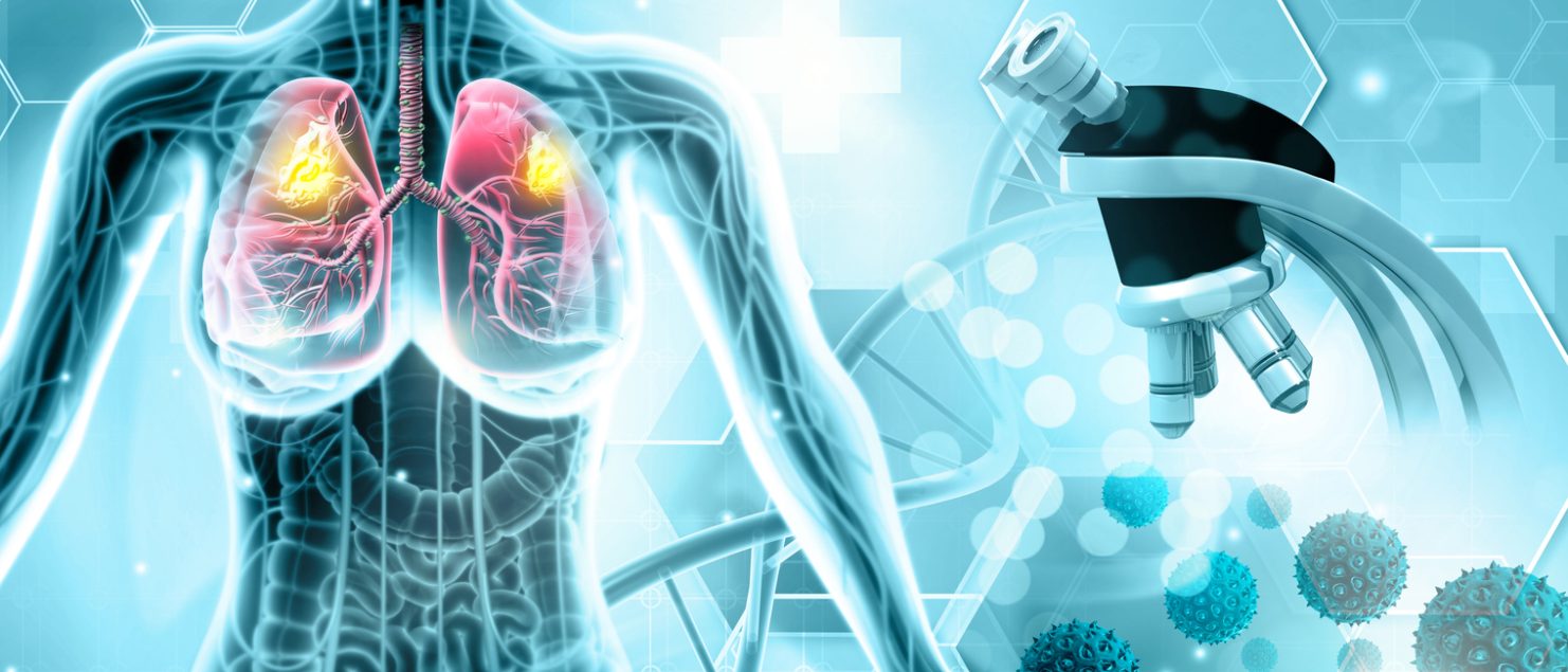 remisia cancerului de plămâni
