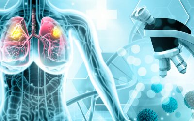 remisia cancerului de plămâni