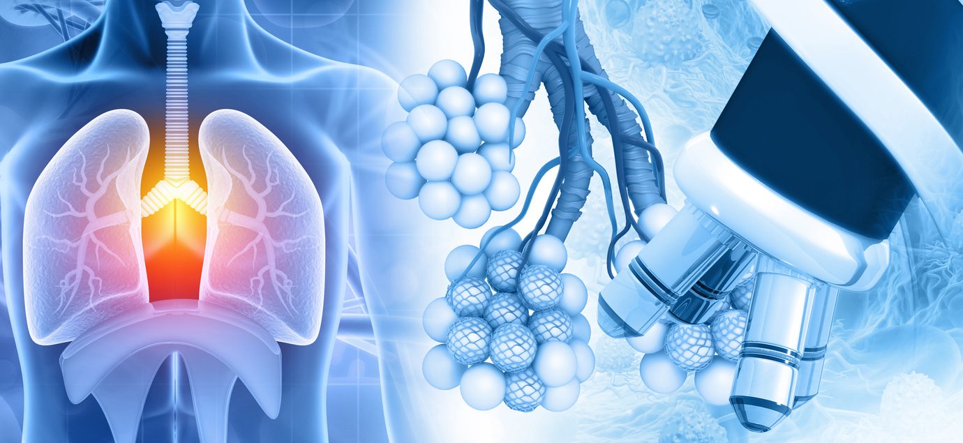 tratament personalizat pentru cancerul pulmonar