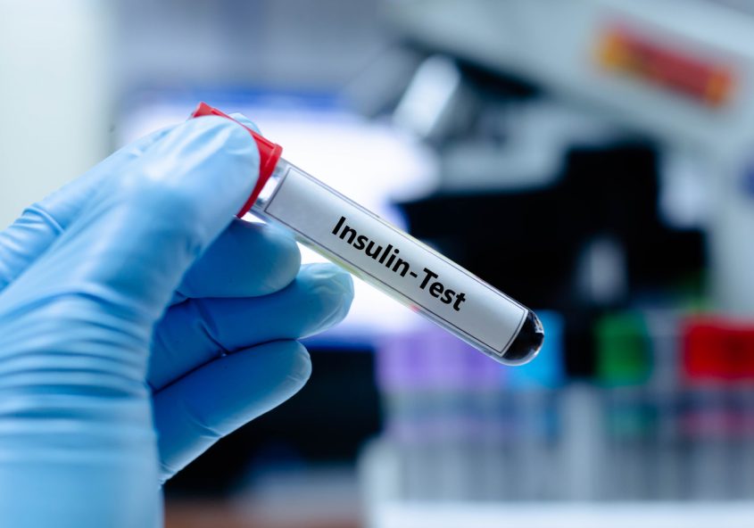 respirația superficială și rezistența la insulină